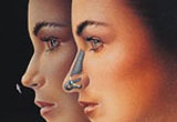 Cost of Nose Surgery