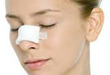 Reshaping Nose without Surgery